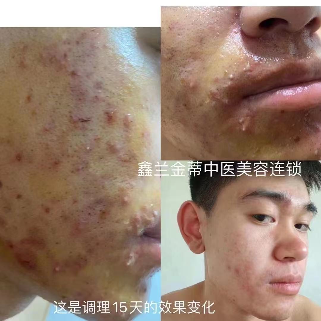 面部案例